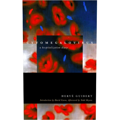 By Hervé Guibert (Author), David Caron (Introduction, Contributor), Clara Orban (Translator), Todd Meyers (Afterword) & 1 more Format: Kindle Edition Cytomegalovirus: A Hospitalization Diary (Forms of Living)
