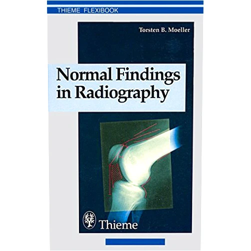 By Torsten B. Moeller (Author) Normal Findings in Radiography (Thieme Flexibook) by Torsten Bert Moeller (1999-10-28)