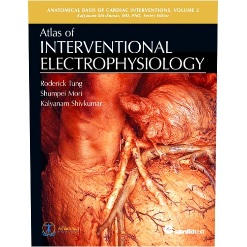 Roderick Tung,Shumpei Mori,Kalyanam Shivkumar Atlas of Interventional Electrophysiology (Anatomical Basis of Cardiac Interventions)