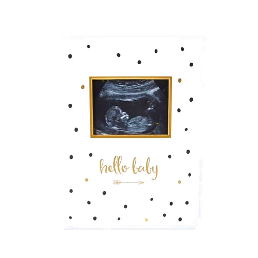 Pearhead Hello Baby First 5 Years Memory Book, Gender-Neutral Baby Keepsake for New and Expectant Parents, Pregnancy And Milestone Journal, Modern Minimalist Black and Gold Polka Dot