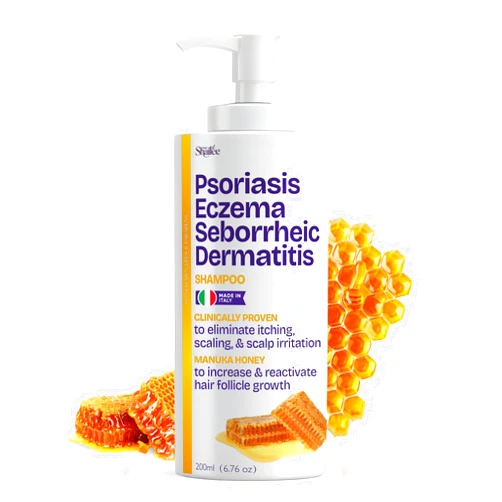 Shailee Psoriasis Shampoo for Eczema, and Folliculitis Treatment - Seborrheic Dermatitis Antifungal Shampoo for Ringworm, Acne, Flaking, Dry & Itchy Scalp Treatment - Psoriasis Relief with Manuka Honey