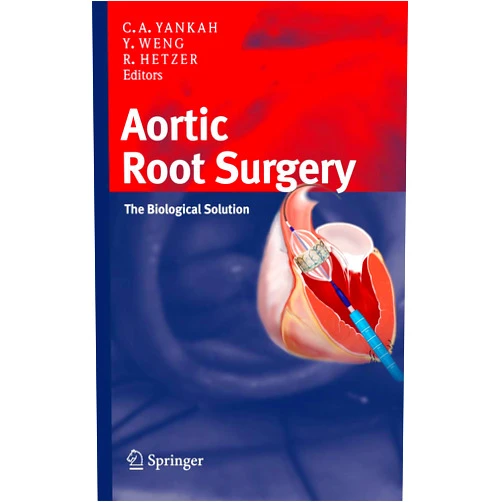 Charles Abraham Yankah,Yu-Guo Weng,Roland Hetzer Aortic Root Surgery: The Biological Solution
