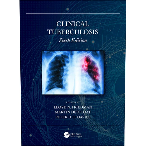Lloyd N. Friedman,Martin Dedicoat,Peter D. O. Davies Clinical Tuberculosis