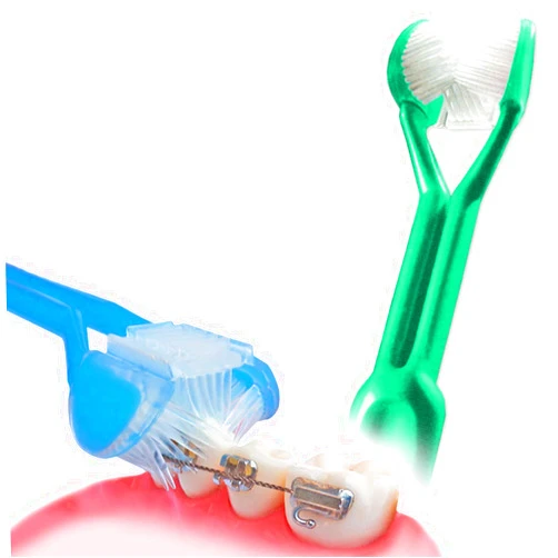 DenTrust Toothbrush Dentrust 3-Sided Braces Toothbrush :: Clinically Proven Better for Orthodontic's :: Easily Cleans Around Brackets :: Rubber Bands Bracket :: Archwire Retainer Headgear Decalcification