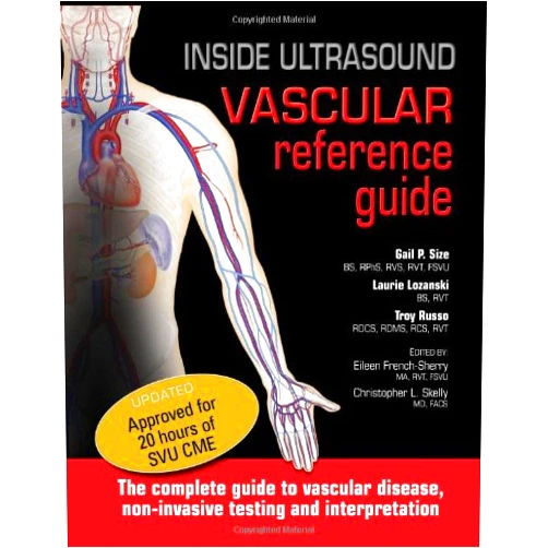 By Gail P. Size (Author) Inside Ultrasound: Vascular Reference Guide