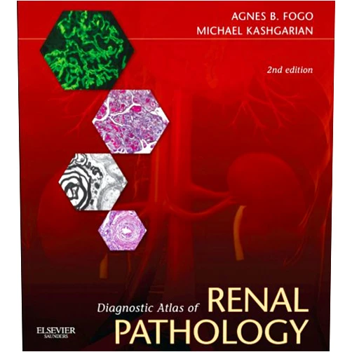 By Agnes B. Fogo (Author), Michael Kashgarian (Author) Format: Kindle Edition Diagnostic Atlas of Renal Pathology: Expert Consult - Online and Print