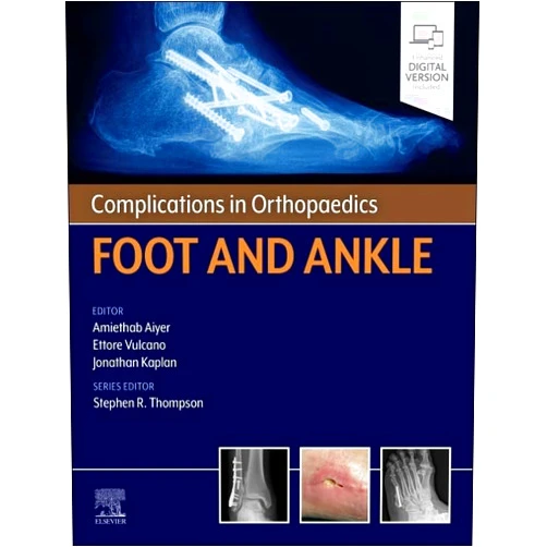 Amiethab Aiyer MD FAOA FAAOS,Ettore Vulcano MD,Jonathan Kaplan MD,Stephen R. Thompson MD MEd FRCSC Complications in Orthopaedics: Foot and Ankle