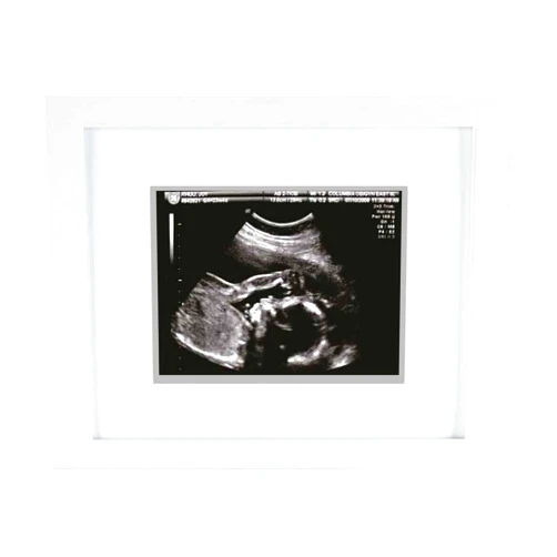 Pearhead Sonogram Photo Frame, Wall Mount An Tabletop Picture Frame, Baby Ultrasound Keepsake, White