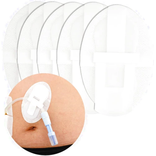 DiaBelt Peritoneal Dialysis PD Catheter Holder Adhesive Patch Stabilization Device for Picc Line Stomach Feeding Peg J Tube G-Tube Urine Foley Catheter | Individually Packed| Non-Woven Dressing (Pack of 5)