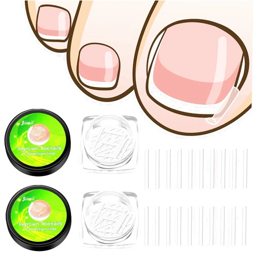 BBTO 100 Pieces Ingrown Toenail Corrector Strips Toenail Correction Patches Curved Toenails Straightening Recover Clips Toenail Straightener Strip for Men Women Foot Care