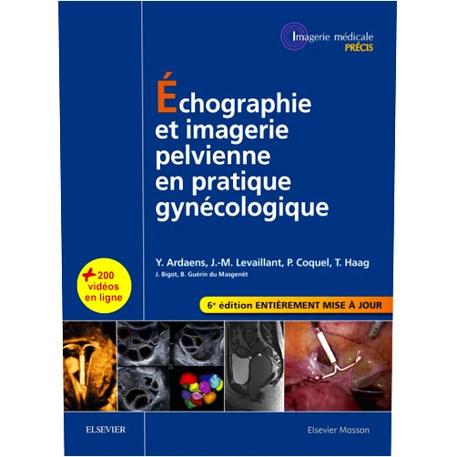 French Edition by Yves Ardaens (Author), Jean-Marc Levaillant (Author), Philippe Coquel (Author), Thierry Haag (Author), Cyrille MARTINET (Illustrator), Carole FUMAT (Illustrator), Laure BESSON (Editor), Catherine Adamsbaum (Contributor), N. Rocourt (Contributor), Sophie Catteau-Jonard (Contributor), A. Chevalier (Contributor), Michel Cosson (Contributor), E. Kamus (Contributor), B. Castelain (Contributor), Fabrice Narducci (Contributor), Antoine Moraux (Contributor), Alain Audebert (Contributor), D. Bodnar (Contributor), Claire-Anne RENAN (Contributor), H. GAUTHIER (Contributor), Anne Mathiot (Contributor), Stéphanie Franchi-Abella (Contributor), Sophie Taieb (Contributor), Marc Constant (Contributor), Paul Billet (Contributor), Geoffroy ROBIN (Contributor), Julien Bigot (Contributor), Bernard Guérin du Masgenêt (Contributor), S. Novellas (Contributor), Alain Gougeon (Contributor), Didier Dewailly (Contributor), Katty Ardaens (Contributor), Thibaud Vernet (Contributor), Sophie Chapelière (Contributor), Eric Leblanc (Contributor), Madleen Chassang (Contributor), Marie-Christine Baranzelli (Contributor), Pauline Plouvier (Contributor), Anne-Sophie Delesalle (Contributor), Luc Ceugnart (Contributor), Bernard BENOIT (Contributor), Alice Fraissinet (Contributor), Catherine Lefebvre (Contributor), Patricia THOMAS (Contributor), Christophe Lions (Contributor) & 41 more Format: Kindle Edition Échographie et imagerie pelvienne en pratique gynécologique (Imagerie médicale : Précis) (French Edition)