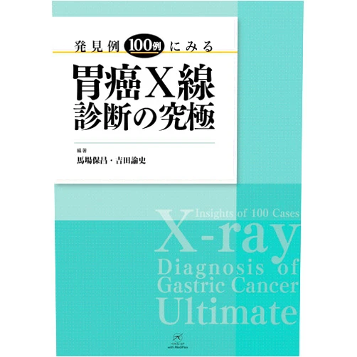 Japanese Edition by Yasumasa Baba Toshifumi Yoshida (Author), Yasumasa Baba (Author), Toshifumi Yoshida (Author) & 0 more Format: Kindle Edition X-ray Diagnosis of Gastric Cancer Ultimate: Insights of 100 Cases (Japanese Edition)