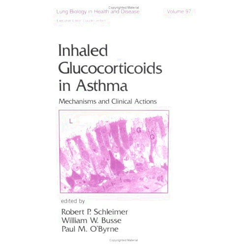 Robert P. Schleimer,William W. Busse,Paul O'Byrne Inhaled Glucocorticoids in Asthma: Mechanisms and Clinical Actions (Lung Biology in Health and Disease)