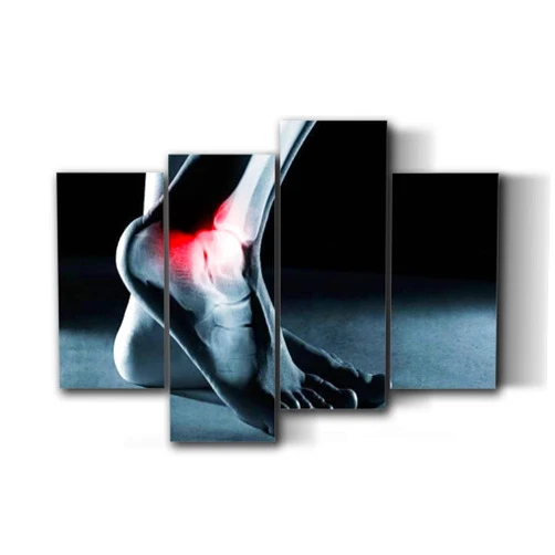 UJOYAFZSIM Orthopedic Human Anatomy Medical Poster foot ankle leg x ray Wall Art Decor for Doctor Office Clinic Gift for Nurse Physicians Assistant Physical Therapist