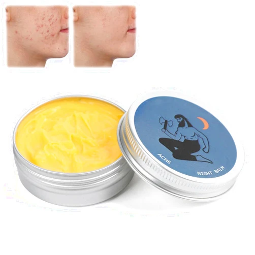 TEPELL Organics Acne Balm, Acne & Redness Killer, Clearing Cream for Man，Remove Skin Care Set(1 pcs)
