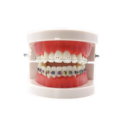 RUCYAI Dental Standard Teeth Model Typodont Metal/Ceramic Brackets for Demonstration (Ceramic)
