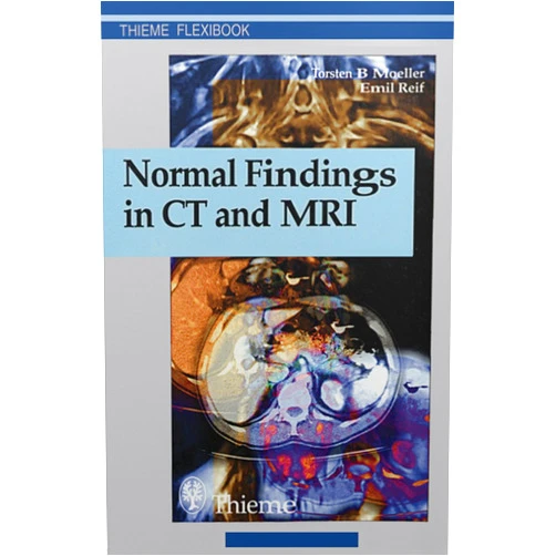 Torsten Bert Moeller,Emil Reif,Torsten Bert Möller Normal Findings in CT and MRI