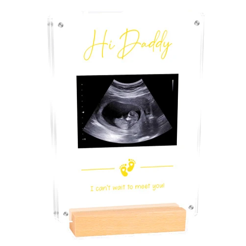 Blinking Stars Acrylic Ultrasound Picture Frame- Hi Daddy Cute Pregnancy Announcement Sign, Baby Reveal Ideas For Husband, Dad To Be Gifts- Nursery Decor Baby Sonogram Photo Frame