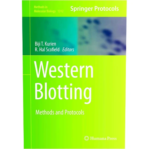 Biji T. Kurien,R. Hal Scofield Western Blotting: Methods and Protocols (Methods in Molecular Biology, 1312)
