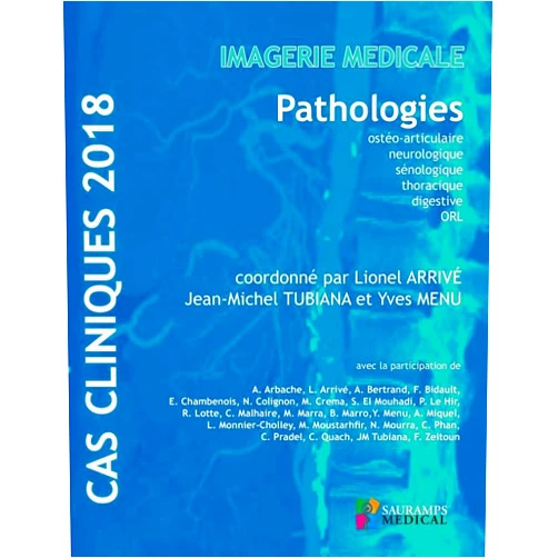 Lionel Arrivé,Jean-Michel Tubiana,Yves Menu Imagerie Médicale: Pathologies Ostéo-articulaire, Neurologique, Sénologique, Thoracique, Digestive, Orl (French Edition)