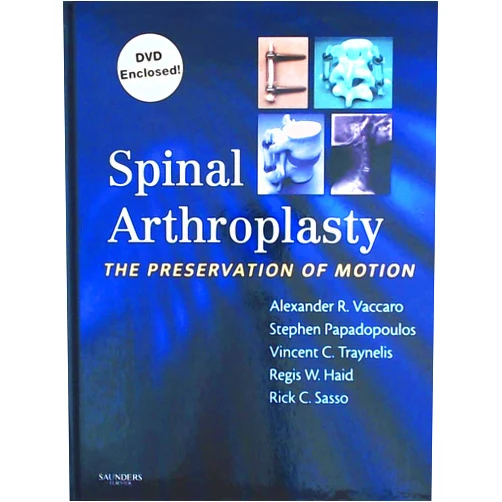 Regis Haid MD,Alexander R. Vaccaro M.D. PhD MBA,Stephen Papadopoulos MD,Vincent Traynelis MD,Rick Sasso MD Spinal Arthroplasty with DVD: The Preservation of Motion