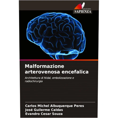 Italian Edition by Carlos Michel Albuquerque Peres (Author), José Guilerme Caldas (Author), Evandro Cesar Souza (Author) & 0 more Malformazione arterovenosa encefalica (Italian Edition)