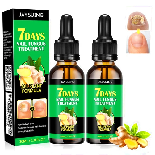 Cuoct 2 PCS Ginger Nail Treatment Nail Support Nail Care, 7Days Nail Treatment, Cuticle Serum for Nails, Ginger Nail Growth Serum, Ginger Cuticle Care Oil for Nails