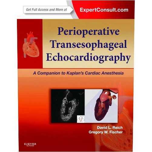 David L. Reich MD,Gregory Fischer MD Perioperative Transesophageal Echocardiography E-Book: A Companion to Kaplan's Cardiac Anesthesia (Expert Consult: Online)
