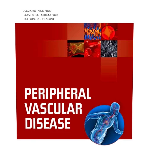 By Alvaro Alonso (Author), Daniel D. McManus (Author), Daniel Z. Fisher (Author) & 0 more Peripheral Vascular Disease: .