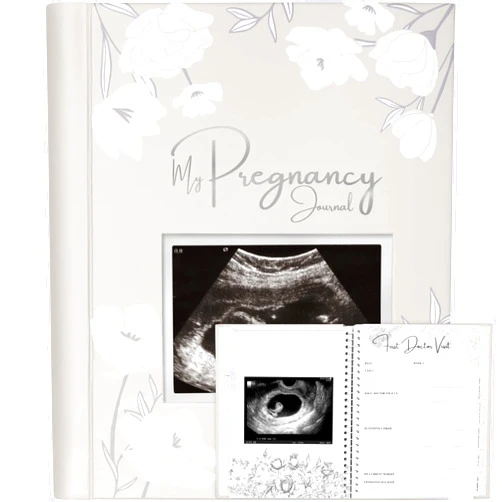 KeaBabies Pregnancy Journal, Pregnancy Announcements - 80 Pages Hard Cover Pregnancy Book For Mom To Be Gift - Pregnancy Gifts For New Moms - First Time Expecting Mom Gift - Baby Album And Memory Book (Clay)