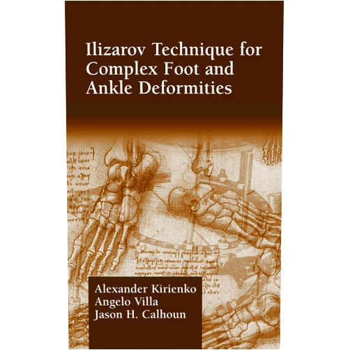 Alexander Kirienko,Angelo Villa,Jason H. Calhoun Ilizarov Technique for Complex Foot and Ankle Deformities