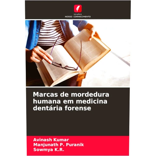 Avinash Kumar,Manjunath P Puranik,Sowmya K R Marcas de mordedura humana em medicina dentária forense (Portuguese Edition)