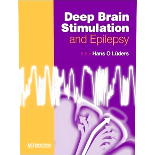 Hans O. Lüders Deep Brain Stimulation and Epilepsy
