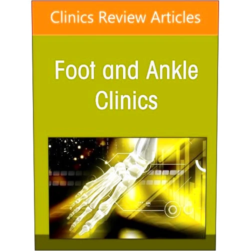 Gonzalo Bastias MD New Trends on Circular External Fixation in the Foot and Ankle, An issue of Foot and Ankle Clinics of North America (Volume 31-2) (The Clinics: Orthopedics, Volume 31-2)