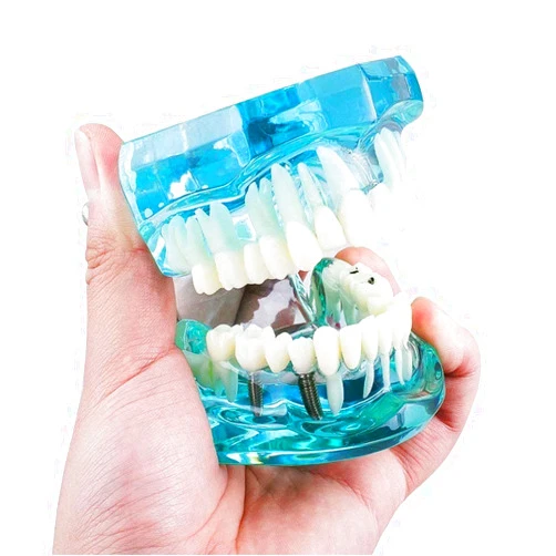 Global-Dental Transparent Teeth Model Standard Teaching Model Blue