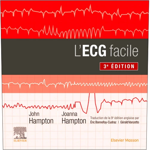 French Edition by John R. Hampton (Author), Joanna Hampton (Author), Eric Bonnefoy-Cudraz (Translator), Gérald Vanzetto (Translator) & 1 more Format: Kindle Edition L'ECG facile (French Edition)