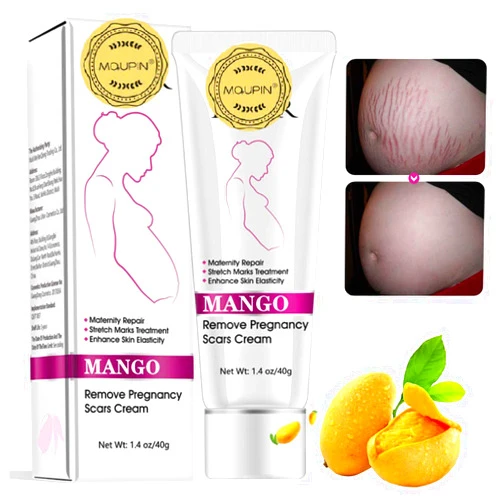 MQUPIN RtopR Mango Stretch Marks and Scar Cream -Stretch Marks and Scar Removal Cream for Pregnancy - Best Body Moisturizer-40g