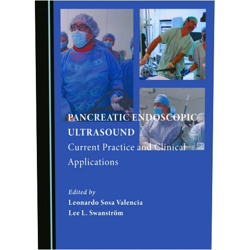 By Leonardo Sosa Valencia (Editor), Lee L. Swanström (Editor) Pancreatic Endoscopic Ultrasound: Current Practice and Clinical Applications