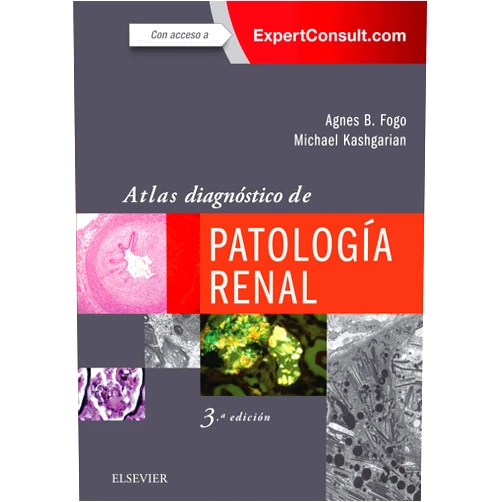 Spanish Edition by Agnes B. Fogo (Author), Michael Kashgarian (Author), SL DRK EDICIÓN (Translator) & 0 more Format: Kindle Edition Atlas diagnóstico de patología renal (Spanish Edition)
