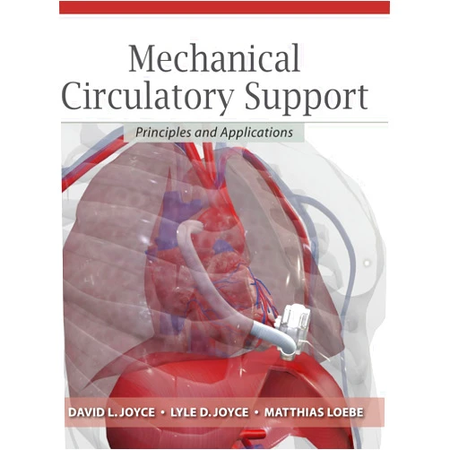 David Joyce,Lyle Joyce,Matthias Locke Mechanical Circulatory Support: Principles and Applications